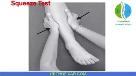 tib fib compression test|The Syndesmosis Squeeze Test .